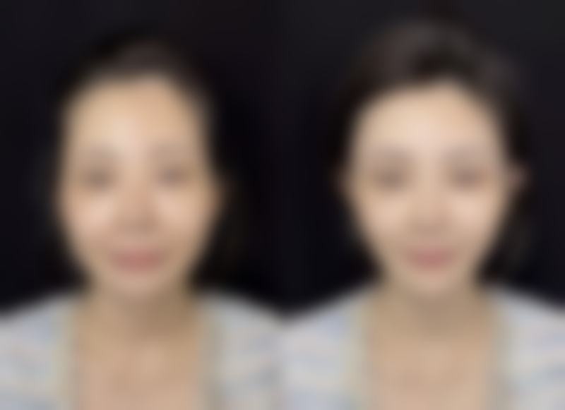 厦门臻医医疗美容门诊部怎么预约