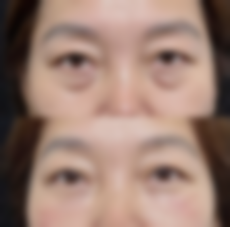 莆田维纳斯医疗整形美容医院口碑评价怎么样?