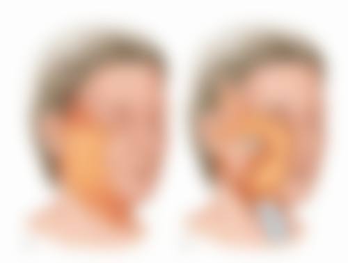 奥美（商丘信阳）整形怎么预约：