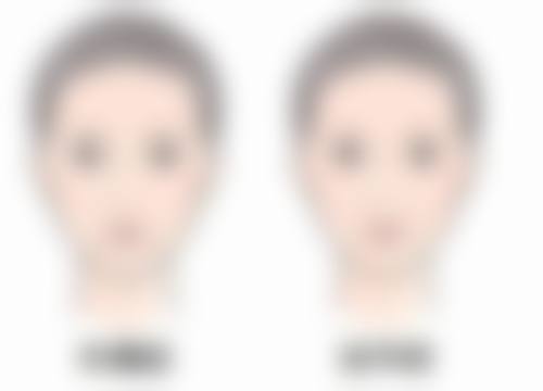 武汉斯启诺医疗美容门诊部眼部综合项目包含哪些产品或手术方式?