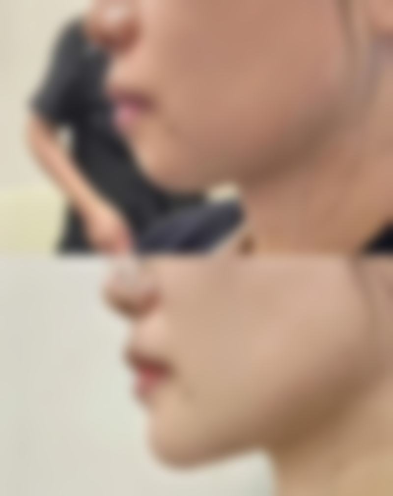 天津申伊医疗美容医院口碑评价怎么样？