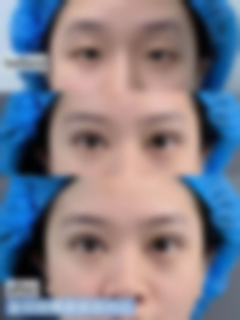 荆门仁爱整形美容医院正规吗?