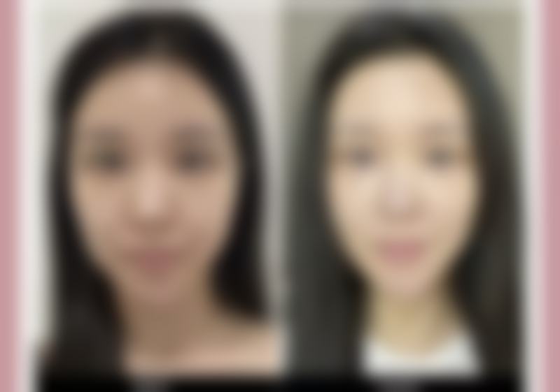 昆明亚婕微美医疗美容门诊部正规吗?