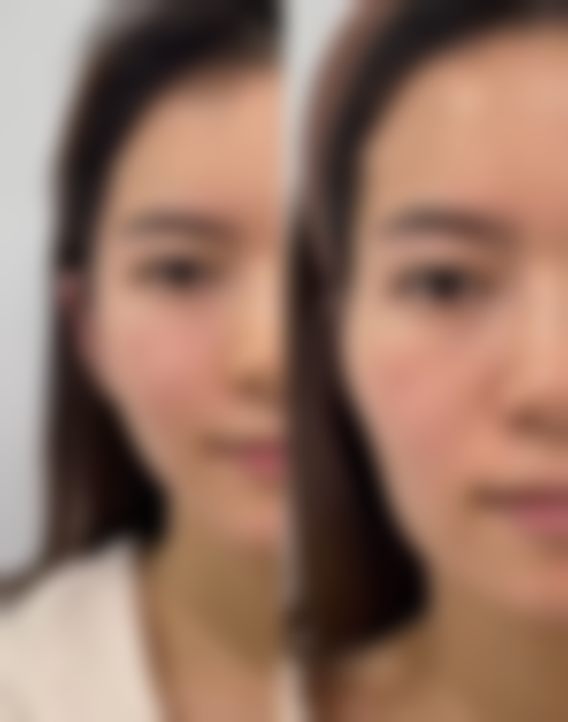 昆明亚婕微美医疗美容门诊部口碑评价怎么样?