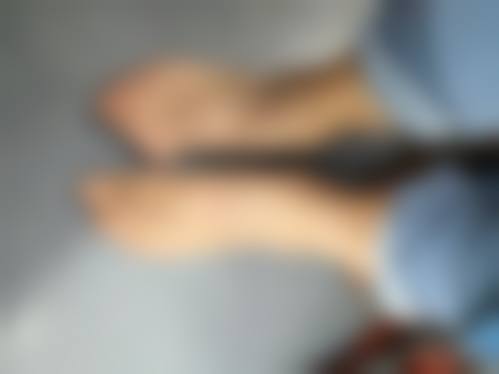 武汉武总植发专科医院汪娇佼医生毛发移植技术怎么样？