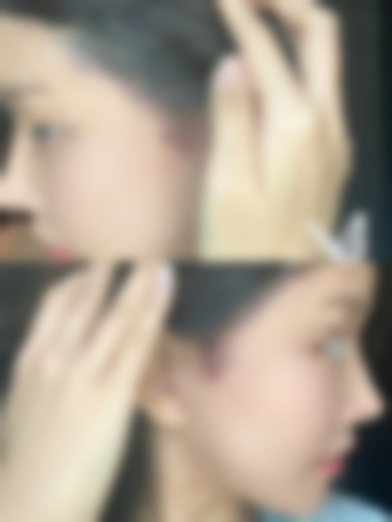 韩国爱美（IMI）整形医院口碑评价怎么样？