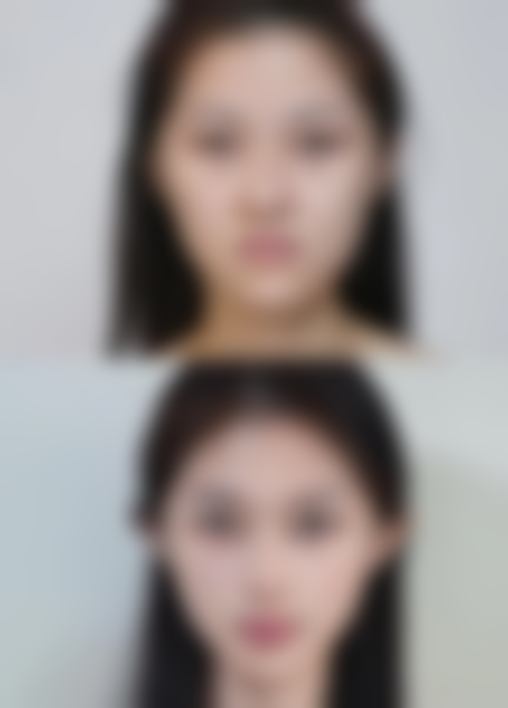 长沙俪姿整形医院正规吗？