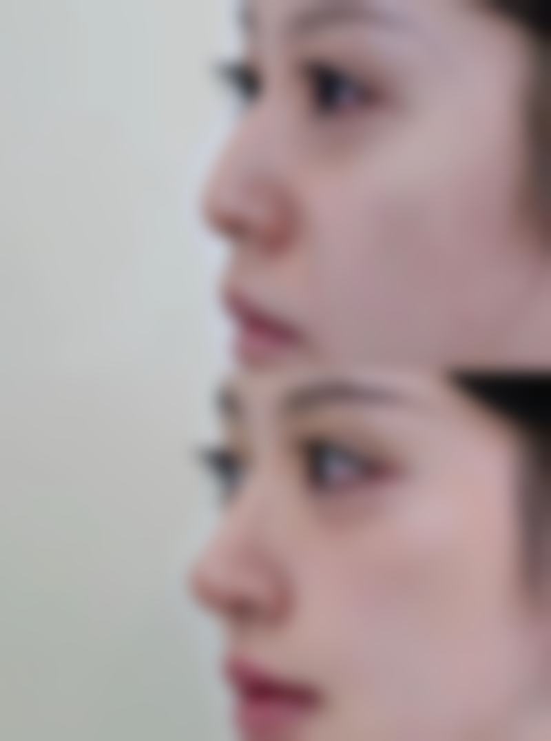 丽江美柏瑞美容医院口碑评价怎么样？