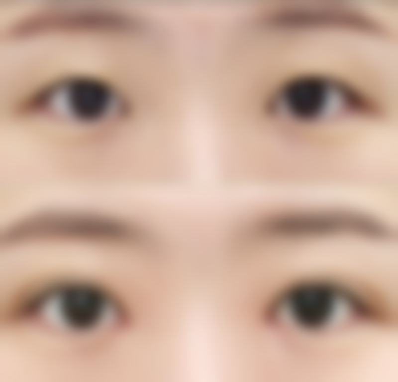 盘锦新御美整形医院怎么预约：