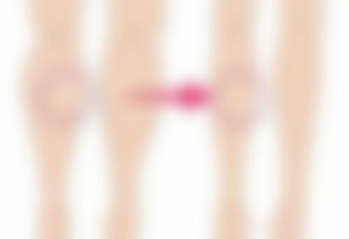 重庆迪邦皮肤病医院袁建琼医生收费价格