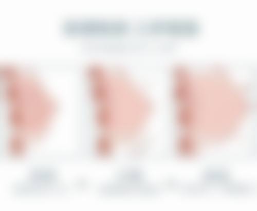 武汉武总植发专科医院杨金梅医生收费价格