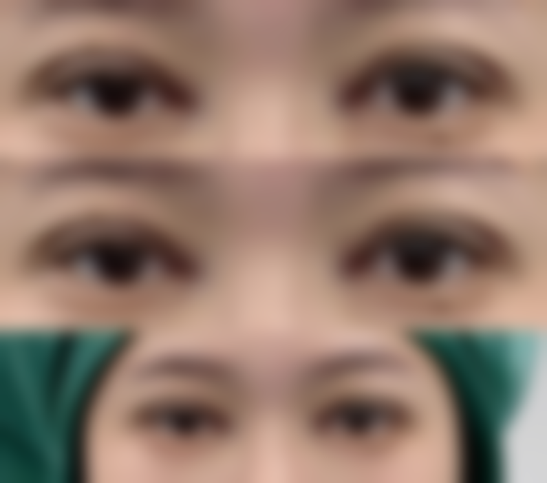 武汉武总植发专科医院杨金梅医生擅长项目