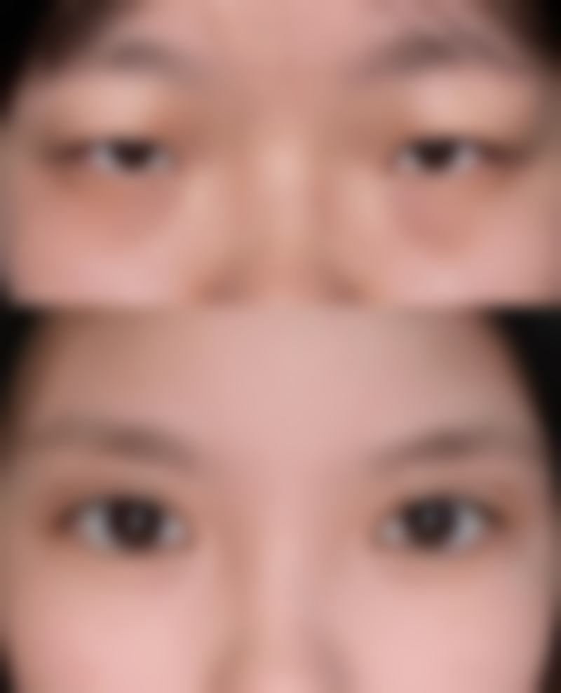 韩国莫德罗皮肤科口碑评价怎么样？