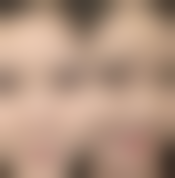 黄山新亚医疗美容门诊部口碑评价怎么样?