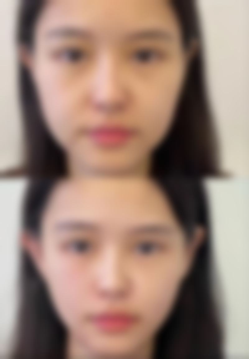 成都王小肤皮肤医疗美容门诊部口碑评价怎么样?