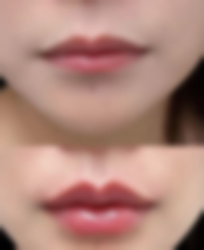 合肥瑞亚整形医院口碑评价怎么样？