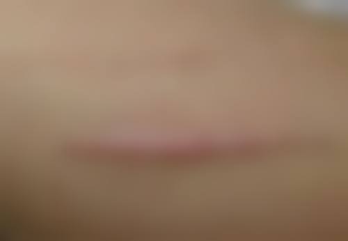 杭州丽蒂羽润医疗美容诊所口碑评价怎么样？