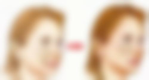 西安鄠邑医美志整形医院正规吗？