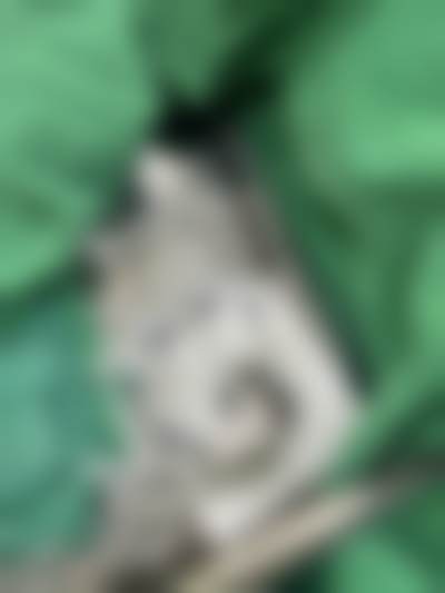 S女性医院李惠妍医生私密整形技术怎么样?