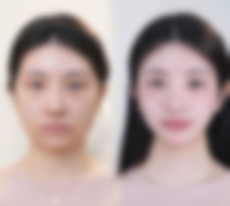 南京安帛医疗美容诊所口碑评价怎么样?