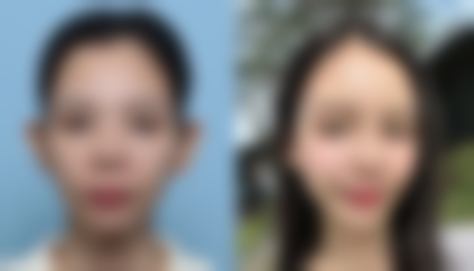 重庆迪邦皮肤病医院翁瑞全医生收费价格