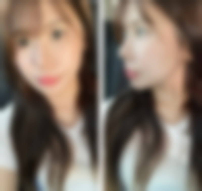 靖江白月光医疗美容诊所正规吗？