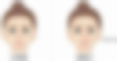 永安茜茜科美医疗美容门诊部钟玉凤医生激光祛斑技术怎么样?