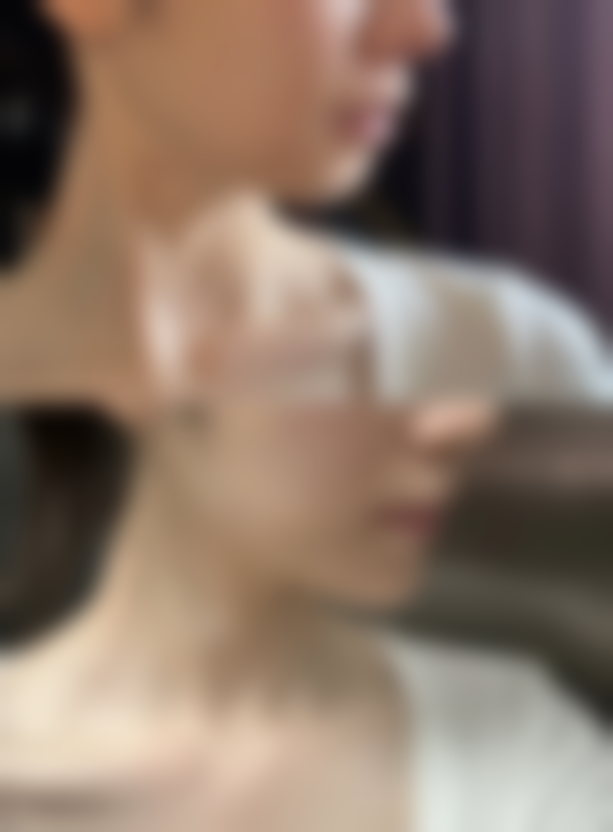 长沙薇美医疗美容门诊部敬甜甜医生患者评价