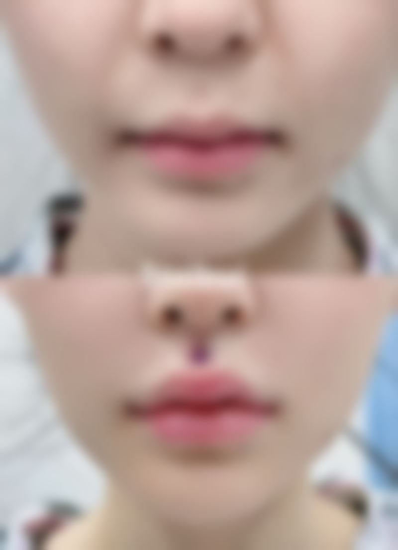 柳州妍美医疗美容诊所朱丹彪医生擅长项目