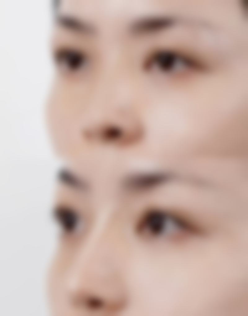 合肥瑞亚整形医院韦清洁医生患者评价