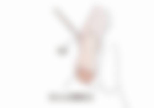 武汉武总植发专科医院汪娇佼医生植发技术怎么样？