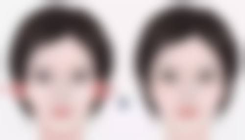 北京博美整形医院袁玲风医生擅长项目