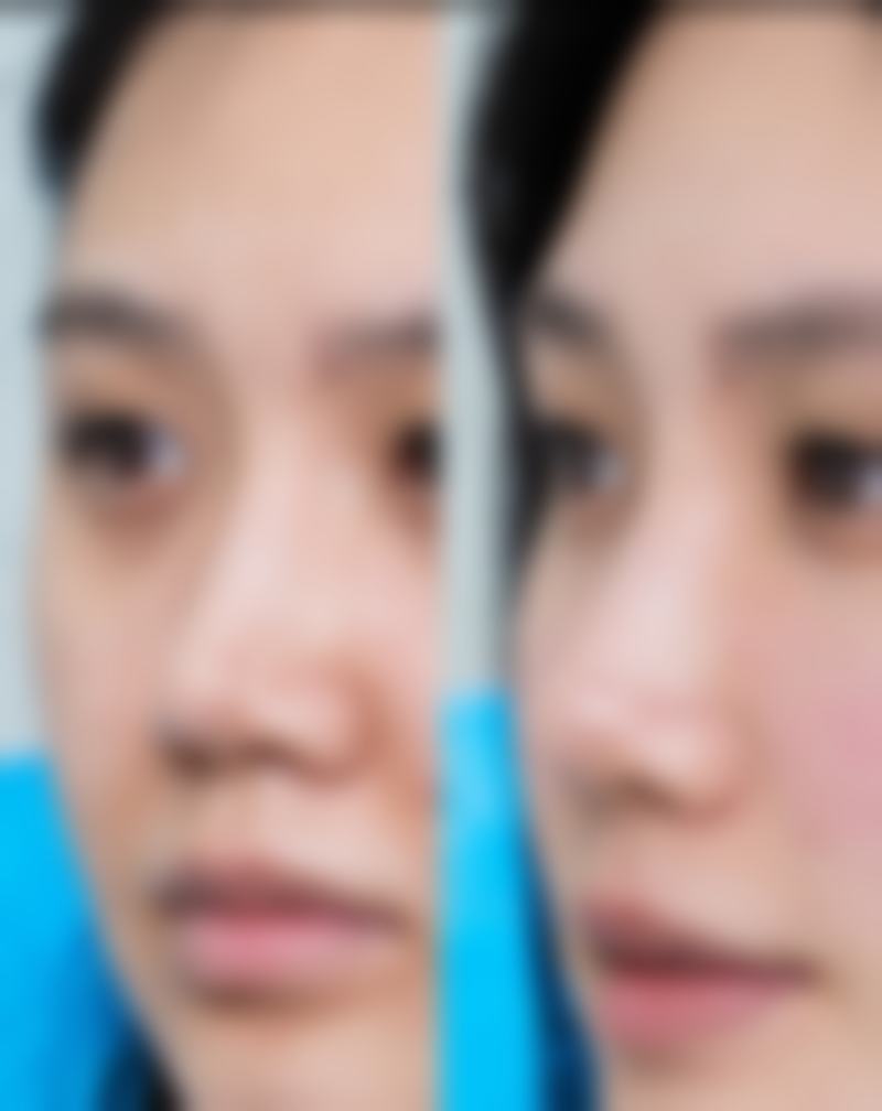 保定杏林整形医院怎么预约