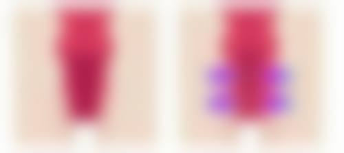 成都武侯雍和华仁医疗美容门诊部林鸿祥医生擅长项目