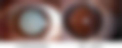 武汉斯启诺医疗美容门诊部仪器抗衰项目使用的是什么产品?