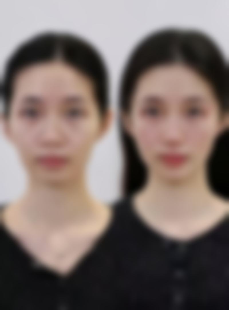 临沂百信瑞元整形医院口碑评价怎么样？