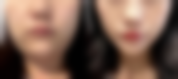 武汉斯启诺医疗美容门诊部彭华伟坐诊的优势