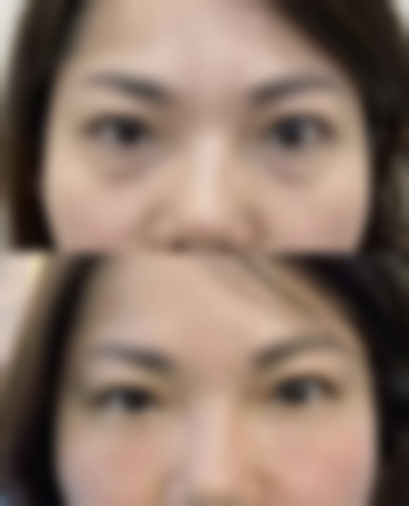 荆门仁爱整形美容医院肖升华医生患者评价