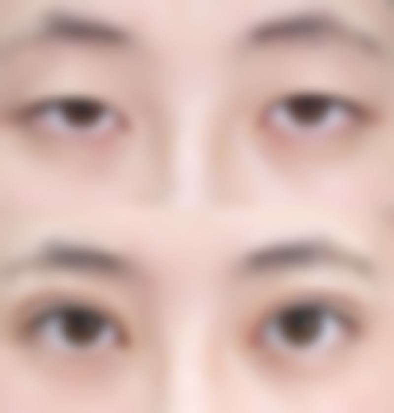 池州伊尚美整形医院正规吗？