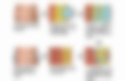 合肥瑞亚整形医院童晓伟医生擅长项目