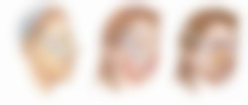 丽江美柏瑞美容医院陈取权医生自体脂肪丰臀技术怎么样？