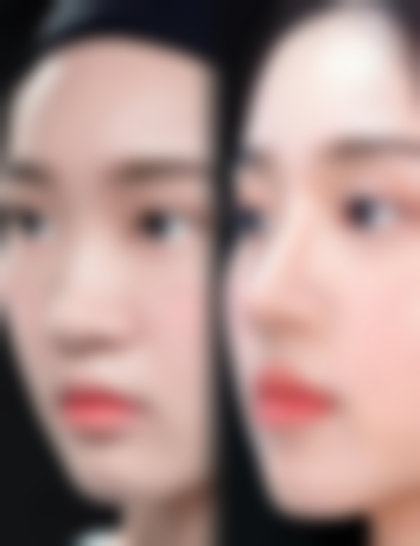 深圳爱氏医疗美容门诊部陈明希医生擅长项目