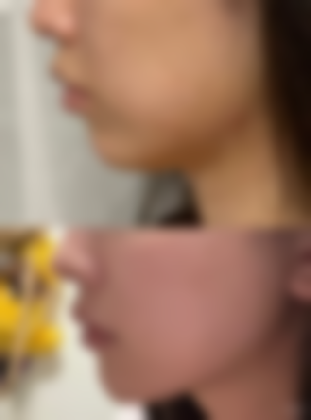 沈阳莱美依美整形医院怎么预约：