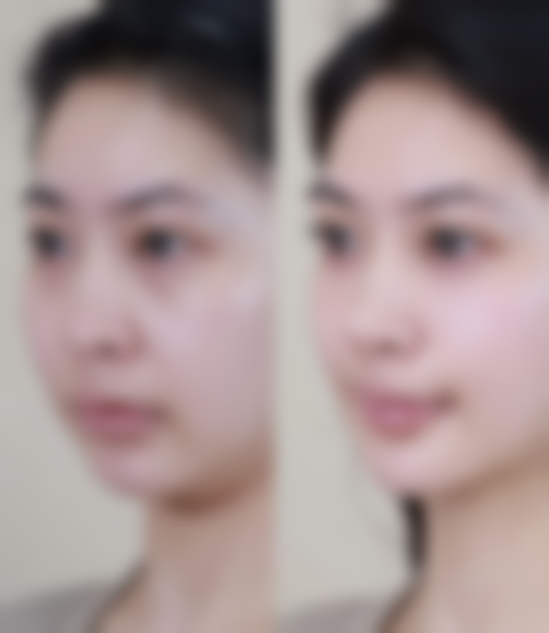 西安圣梦尚嘉整形医院怎么预约