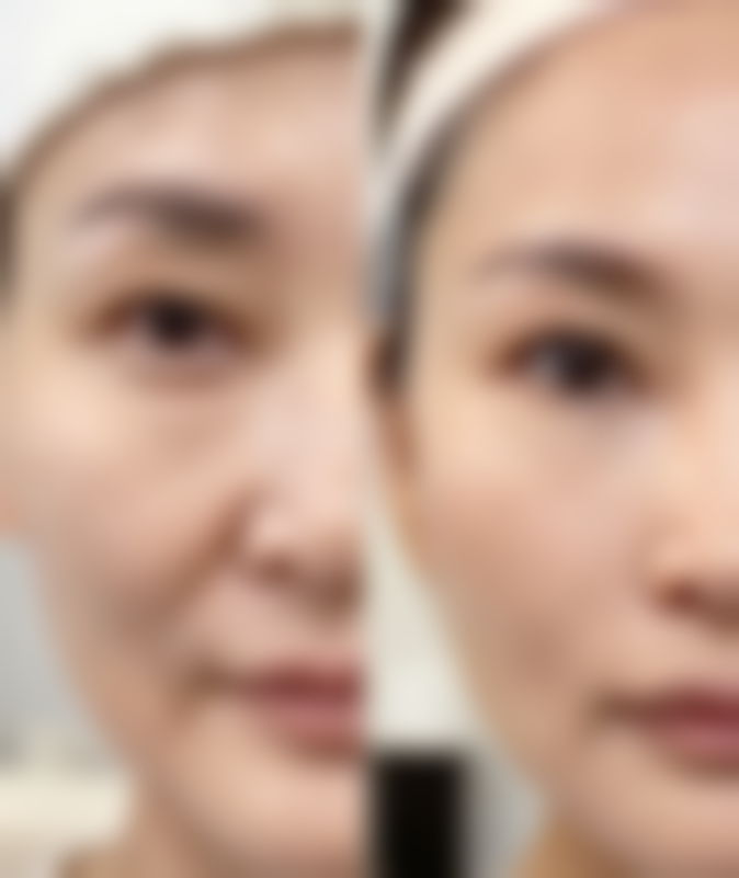 合肥瑞亚整形医院童晓伟医生预约挂号指南