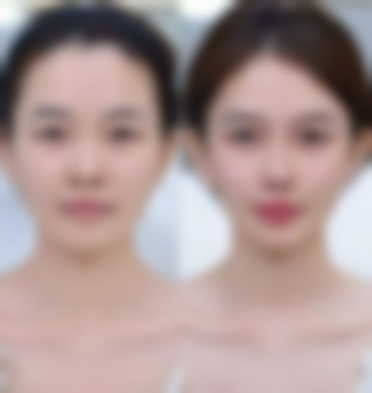 长春伶秀致美整形医院怎么预约