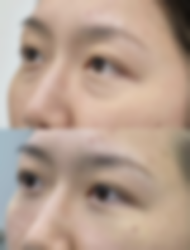 海南琼海华韩整形美容医院时念华医生患者评价