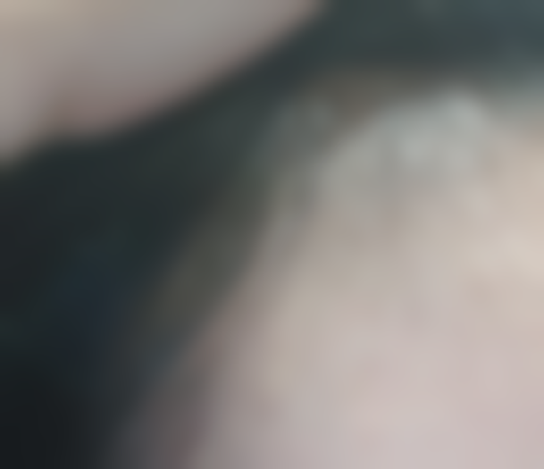 成都华美紫馨医学美容医院植发分享：术后三月效果渐显，期待早日摆脱刘海束缚！ 