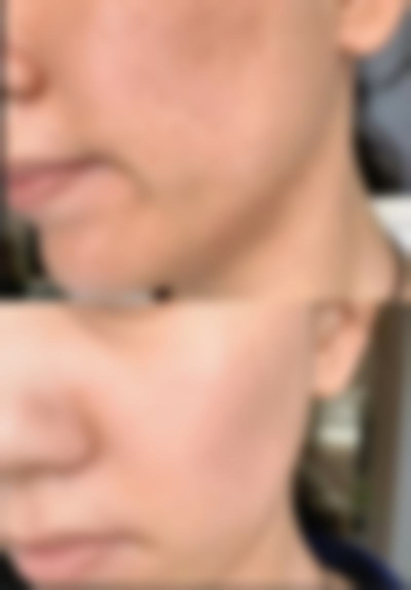 湖南永州倾城医疗美容正规吗?