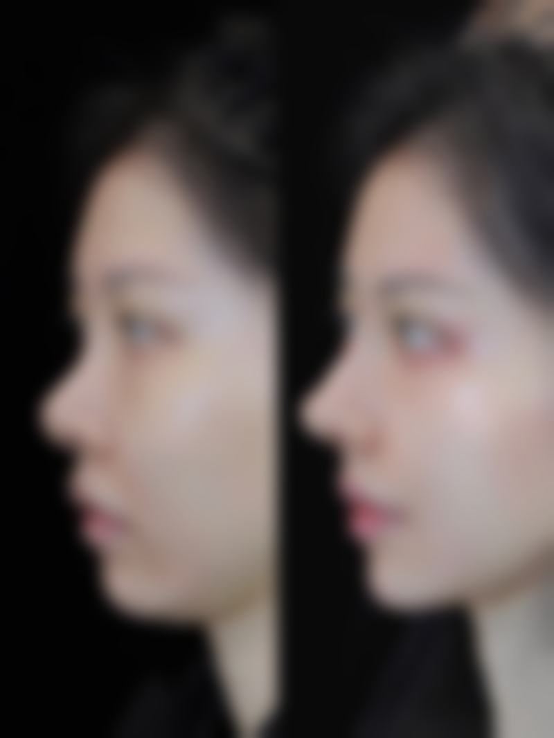 南京灵芝源医疗美容诊所正规吗？